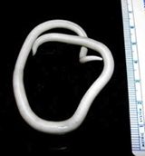Adult A. lumbricoides worm:: Image Courtesy Division of Parasitic Diseases/Centers for Disease Control and Prevention
